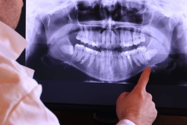 Best Emergency Tooth Extraction in Ashville, OH