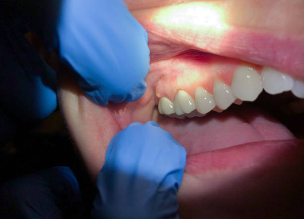  Ashville, OH Emergency Dentist Pros