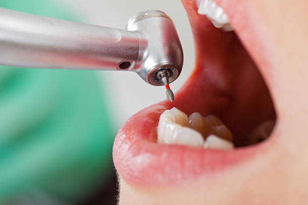 Best Weekend Emergency Dentist in Ashville, OH